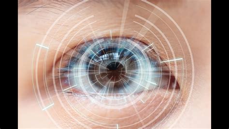 czech republic laser eye surgery